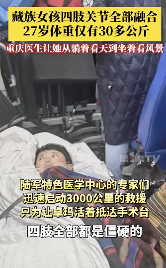 藏族女孩四肢关节全部融合卧床多年