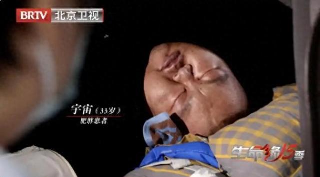718.8斤男子刷新中国第一胖纪录,55天减重230斤