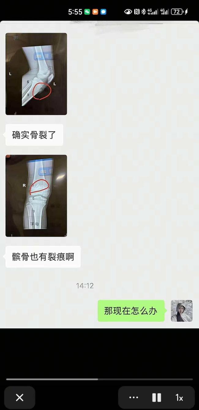 从“免费踢球”到“18万赎身”，是孙继海的青训模式错了吗？