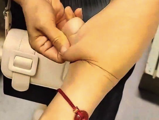 女子皮肤可拉伸几厘米如橡皮人，松到可随意拉扯