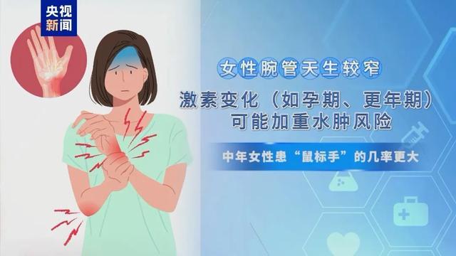 “鼠标手”被纳入职业病！别等肌肉萎缩才重视，医生提醒→